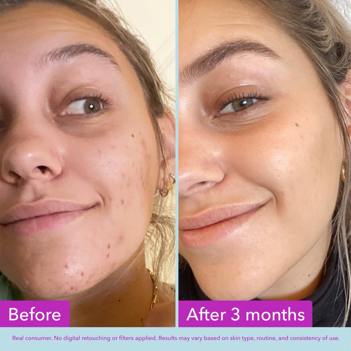 niacinamide-brightening-toner-e7 zb_p.jpg