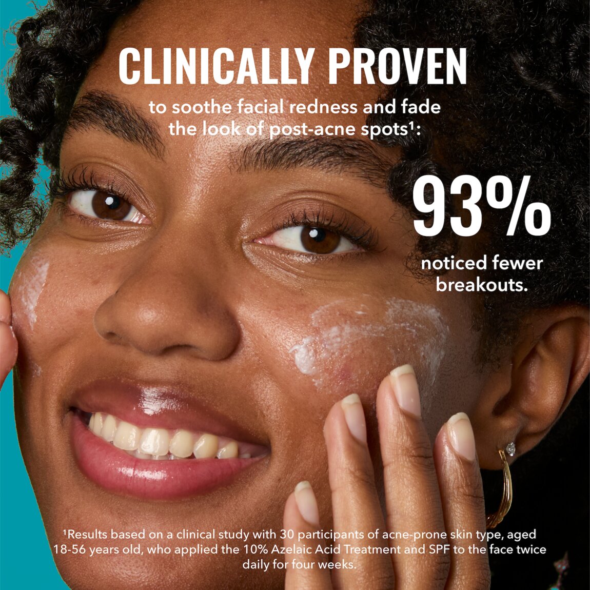 10-azelaic-acid-treatment-n8 zb_p.jpg